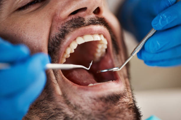 Best Broken or Cracked Tooth Emergency Dentist in Woodsfield, OH