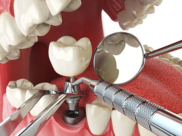 Best Emergency Dental Services for Seniors in Woodsfield, OH